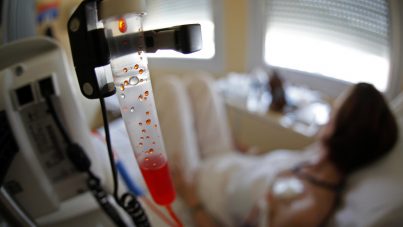 Estudio: Sobrevivientes de cáncer envejecen más rápido y mueren antes