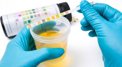 laboratorio japonés lanzará lo que presenta como los primeros ensayos en el mundo destinados a detectar el cáncer a través del análisis de muestras de orina