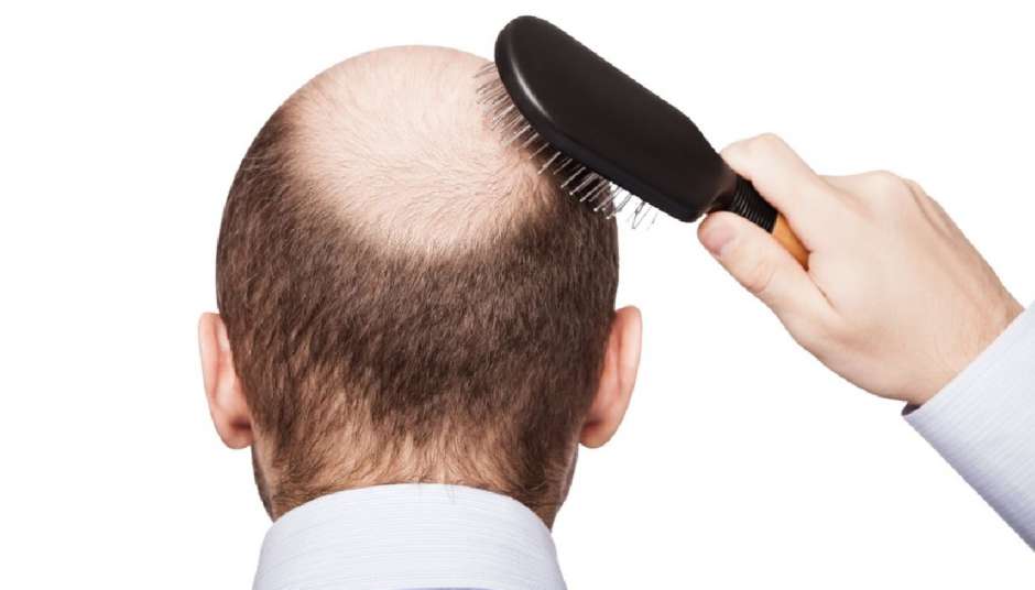 investigadores japoneses encontró un método para regenerar el cabello