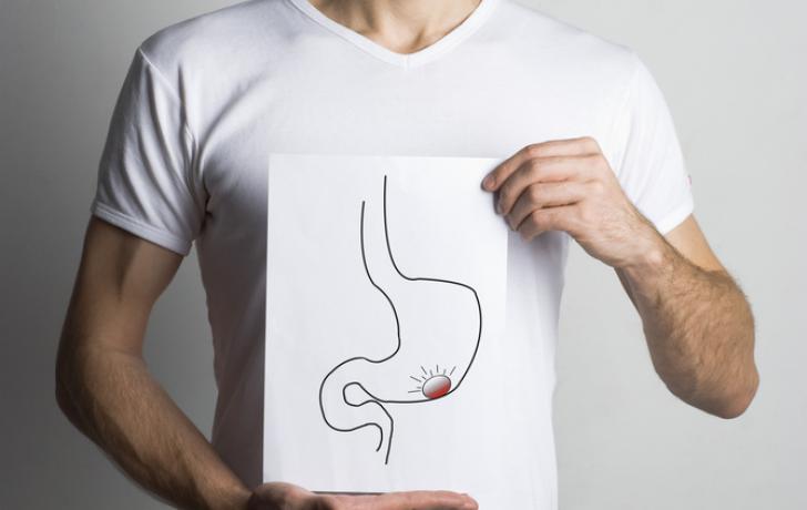 El cáncer de estómago está relacionado con la edad y es difícil de prevenir