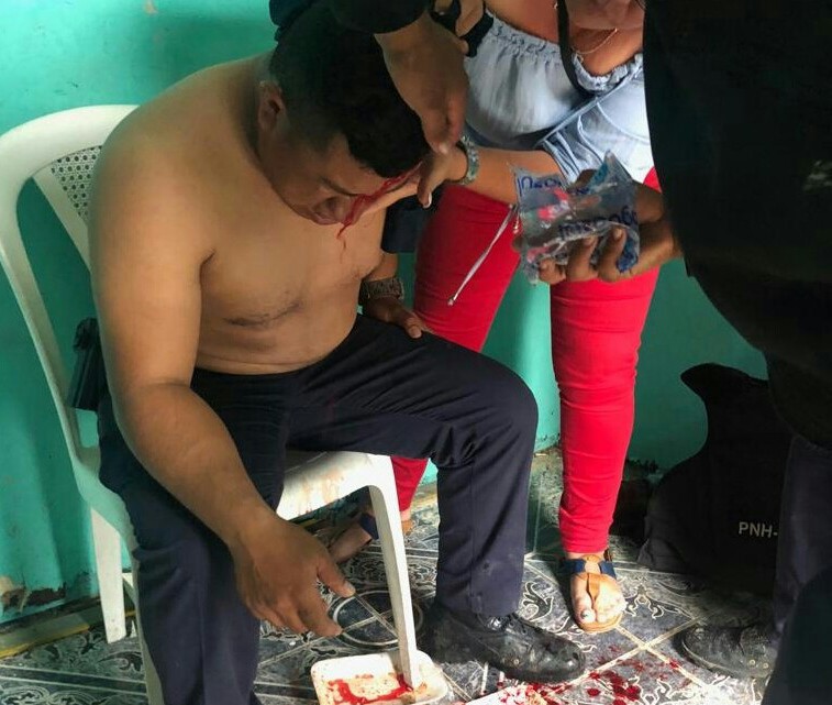 Varios heridos en enfrentamiento entre policías y migrantes en punto fronterizo de Agua Caliente