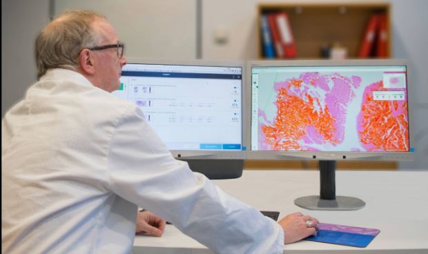 Investigadores desarrollan nuevo modelo de evaluación utilizando imágenes médicas para evaluar sin dolor la progresión del tumor en los pacientes.