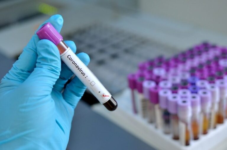 Jefe del Laboratorio de Virología del norte dice que faltan reactivos para realizar pruebas Covid-19