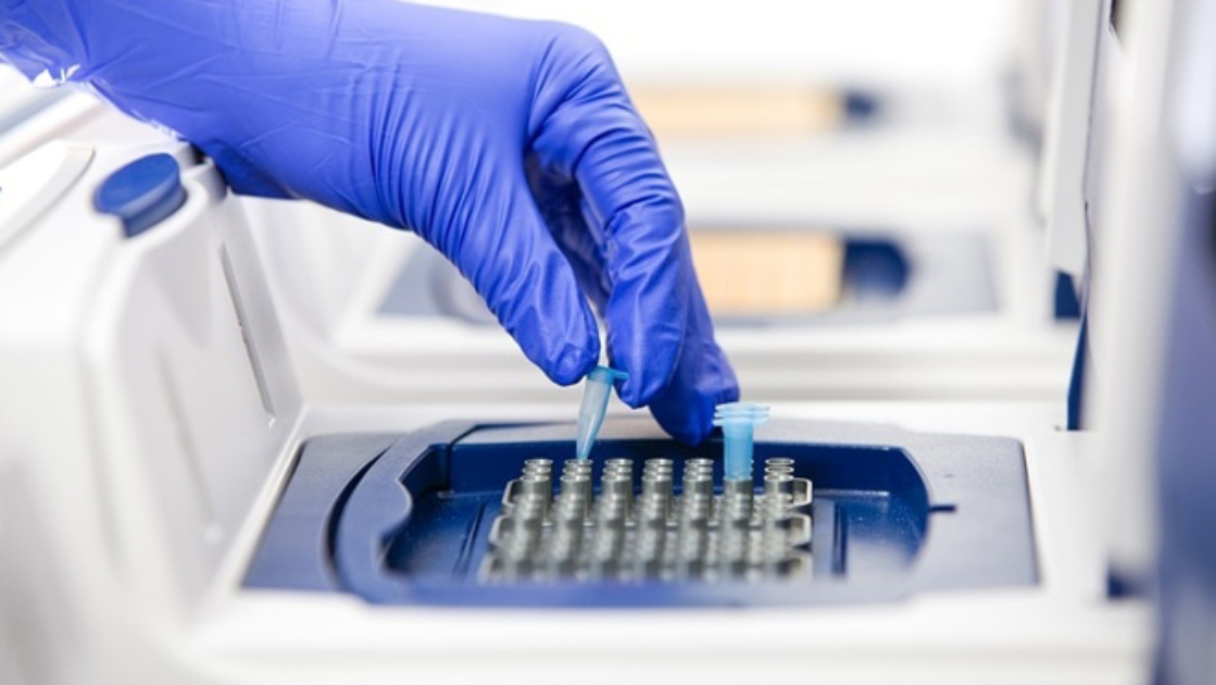 Médico sugiere hacer pruebas PCR en los centros de triaje y subir nivel de atención de pacientes críticos