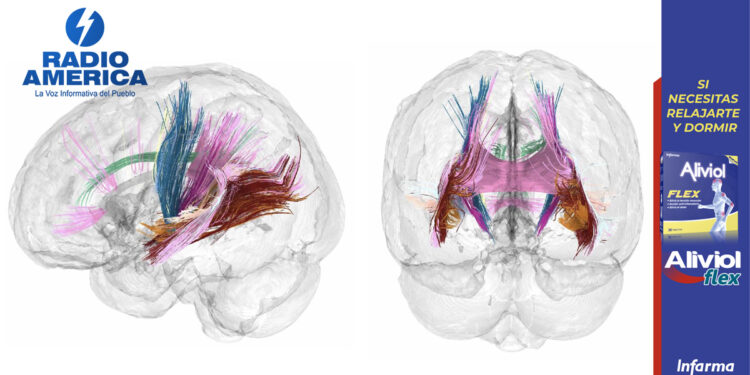 El cerebro de la mujer disminuye de tamaño durante el embarazo, según estudio