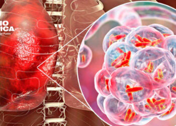 Tuberculosis_radioamérica jpg