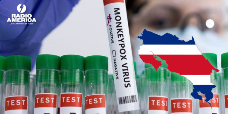 Costa Rica detecta dos casos de viruela del mono y activa protocolos de vigilancia